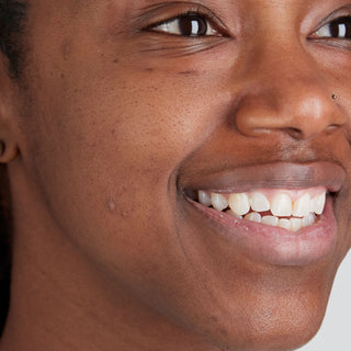 BTBS Dry Skin Regimen Page | B+A Tile 3 Image File [Before]