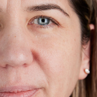 BTBS Dry Skin Regimen B+A Grid | Image 1 File [Before] 