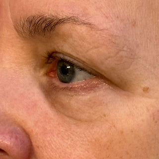 BTBS Fine Lines Regimen Page | B+A Tile 4 Image File [After]