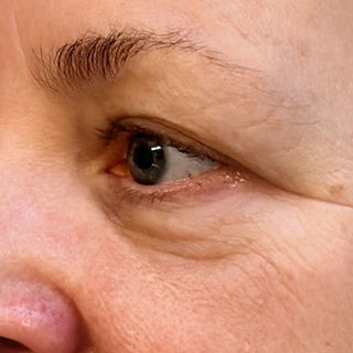 BTBS Fine Lines Regimen Page | B+A Tile 3 Image File [Before]
