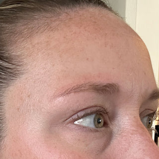 BTBS Fine Lines Regimen Page | B+A Tile 2 Image File [After]
