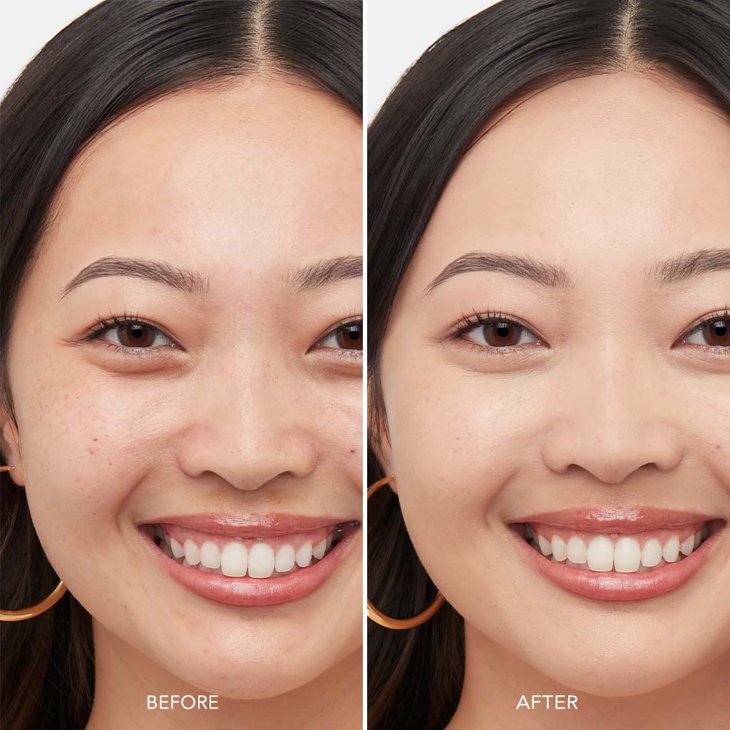 Before and after image showing skincare improvement on woman's face.
